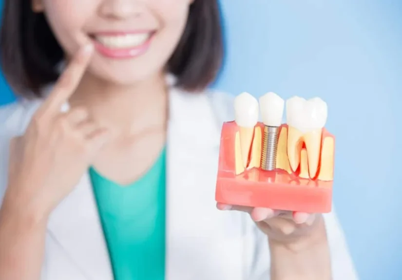 The Cost of Dental Implant in Korea