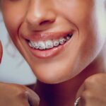 Everyday Confidence Through Discreet Smile Solutions