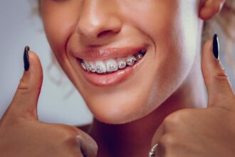 Everyday Confidence Through Discreet Smile Solutions